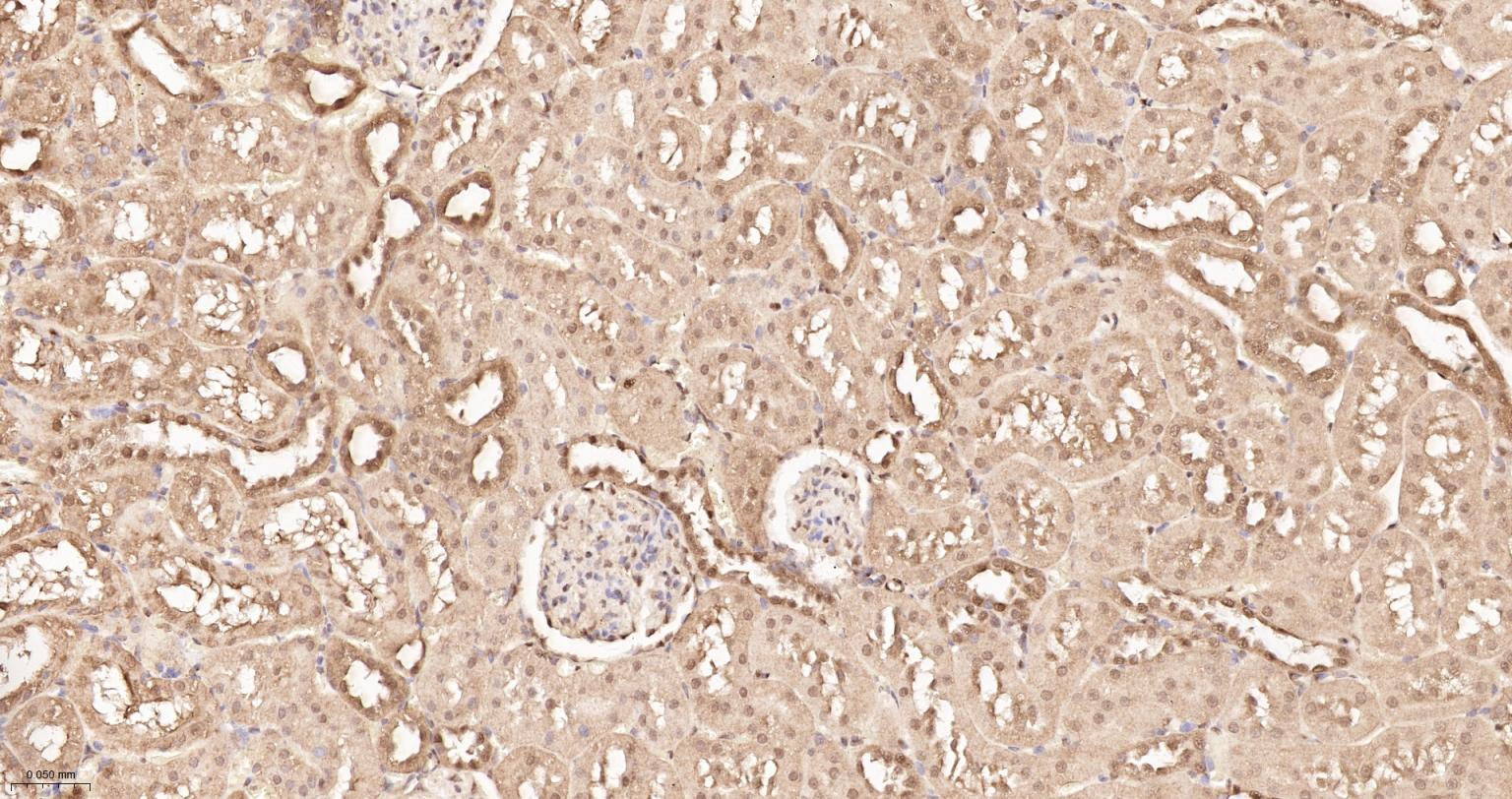 泛素蛋白重组兔单抗