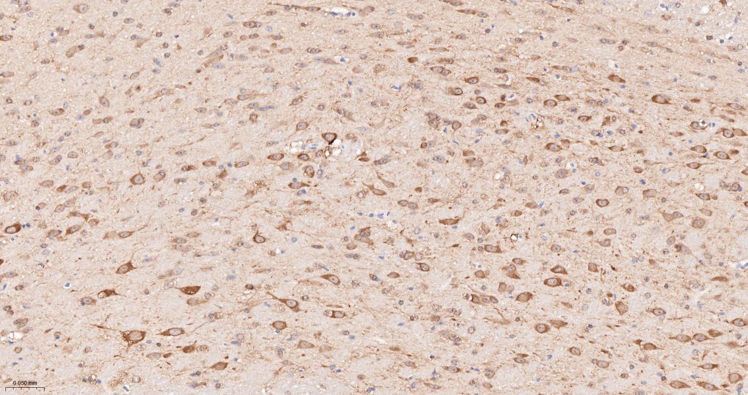 热休克蛋白90α重组兔单抗