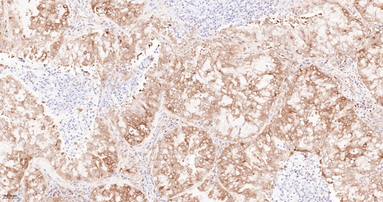 热休克蛋白90α重组兔单抗