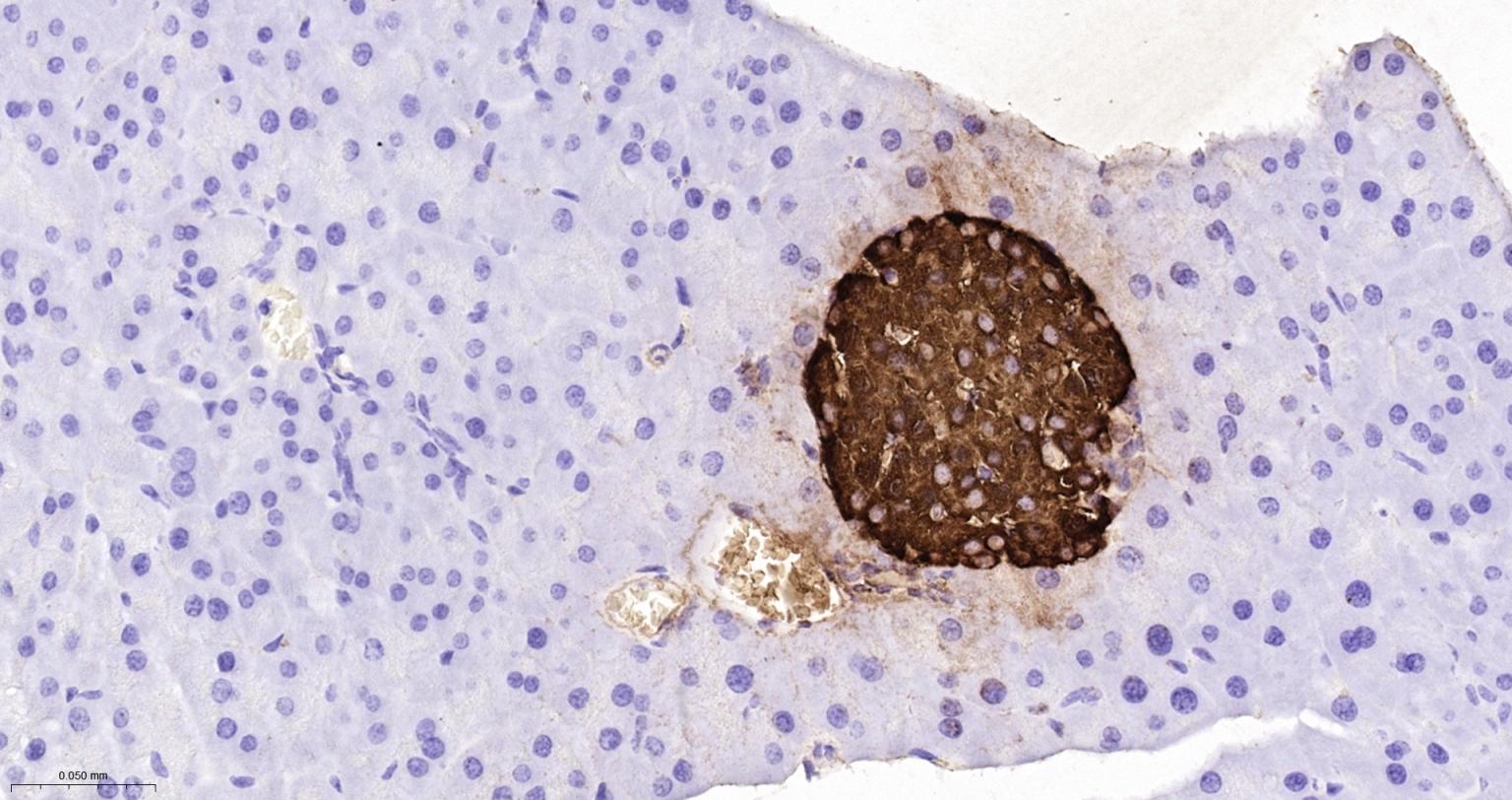 胰岛素重组兔单抗