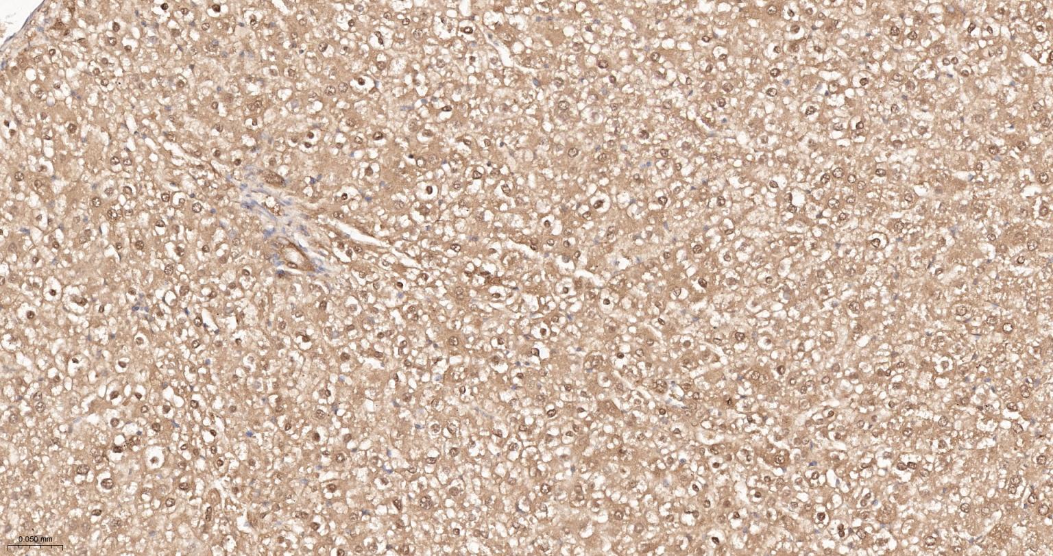 泛素蛋白重组兔单抗