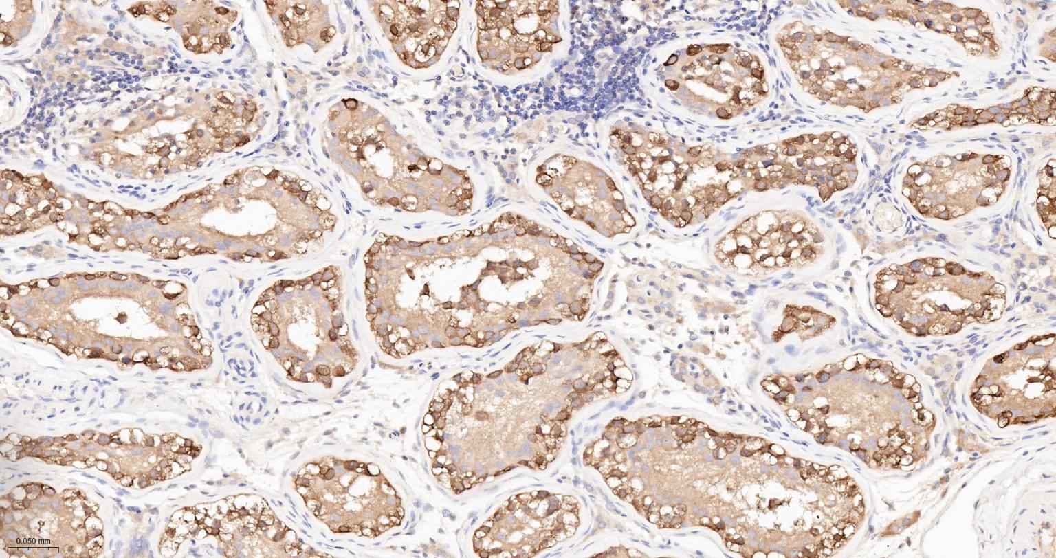 热休克蛋白90α重组兔单抗