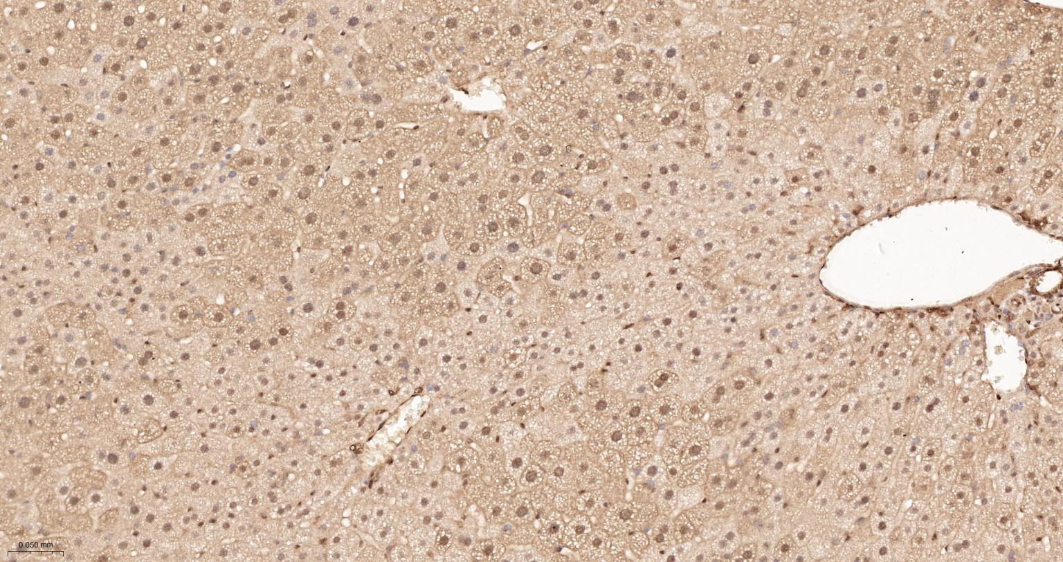 泛素蛋白重组兔单抗