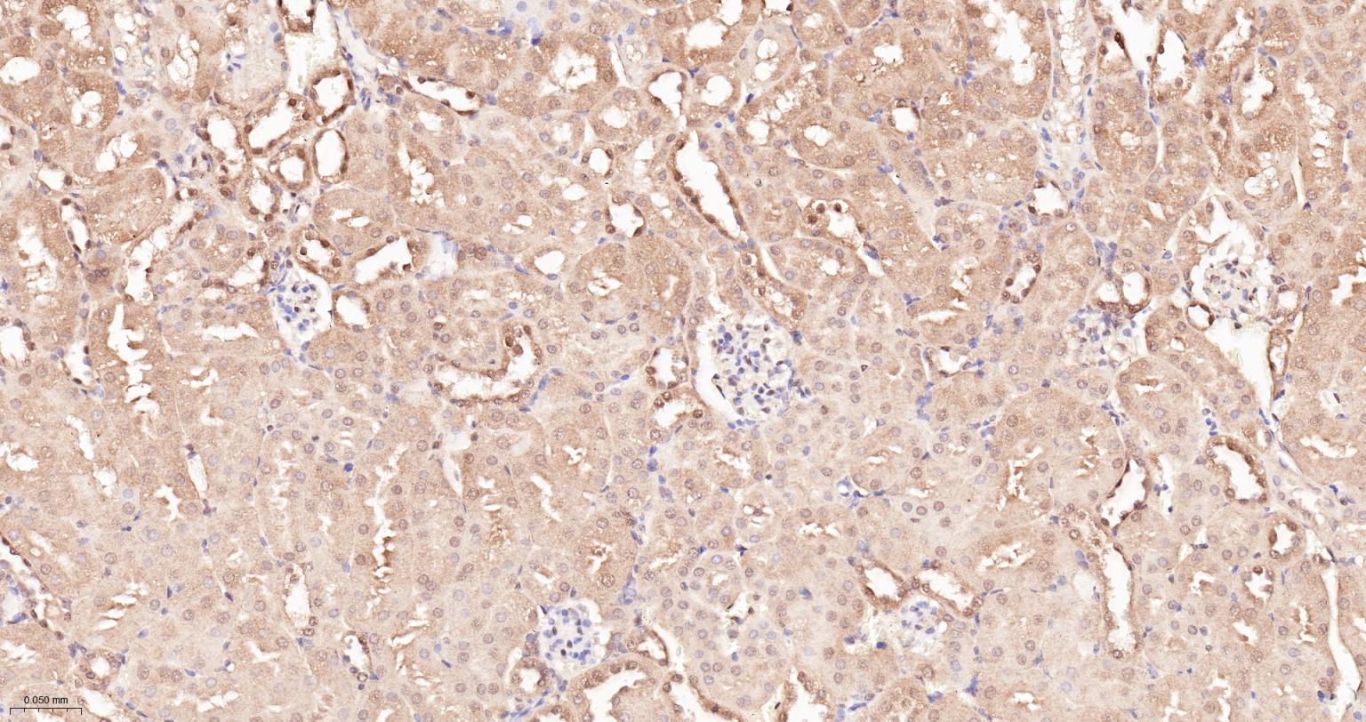 泛素蛋白重组兔单抗