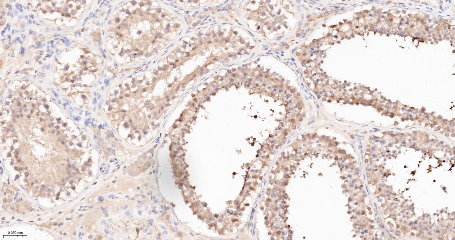 泛素蛋白重组兔单抗