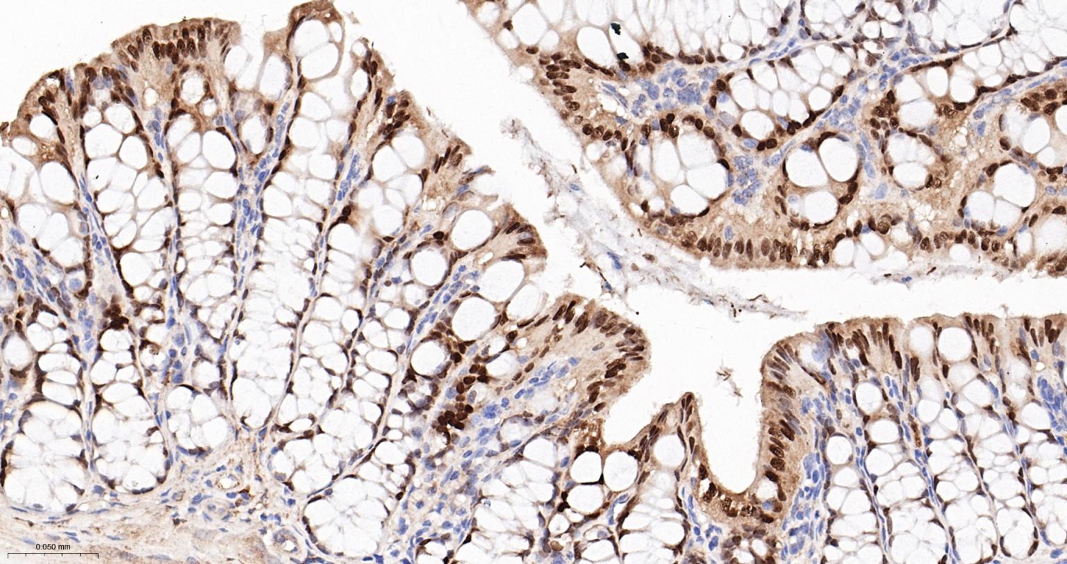 尾型同源盒转录因子2重组兔单抗