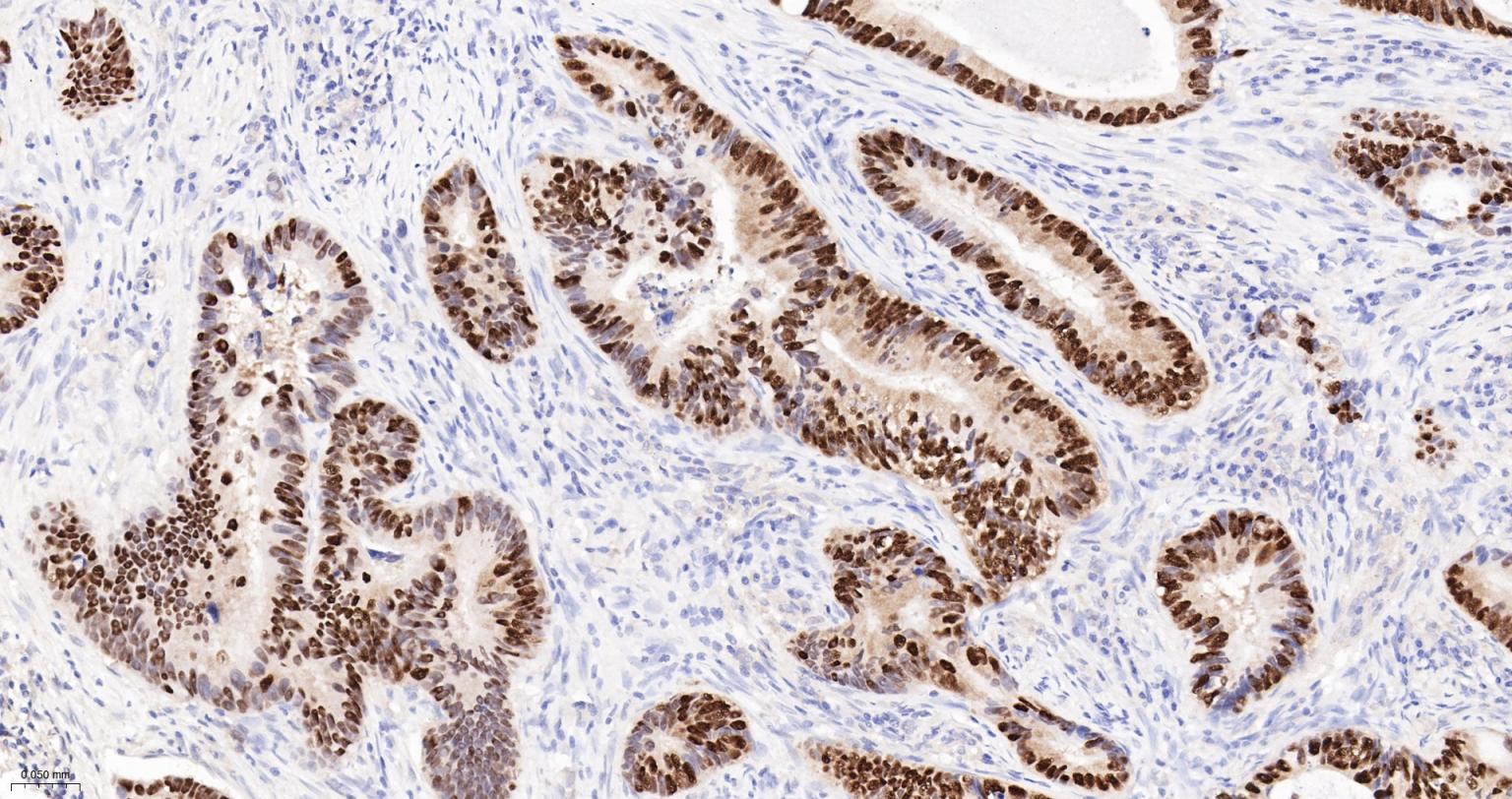 尾型同源盒转录因子2重组兔单抗