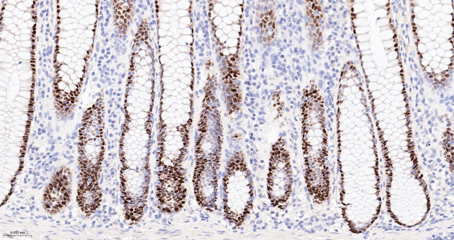 尾型同源盒转录因子2重组兔单抗