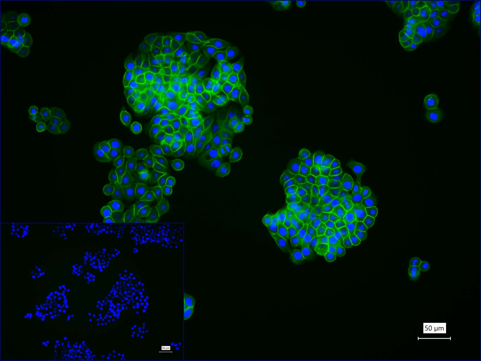 上皮钙粘附分子重组兔单克隆抗体