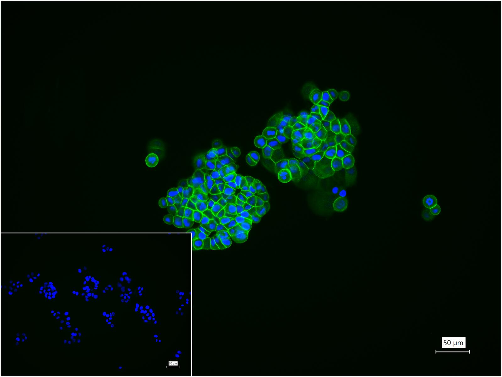 上皮钙粘附分子重组兔单克隆抗体