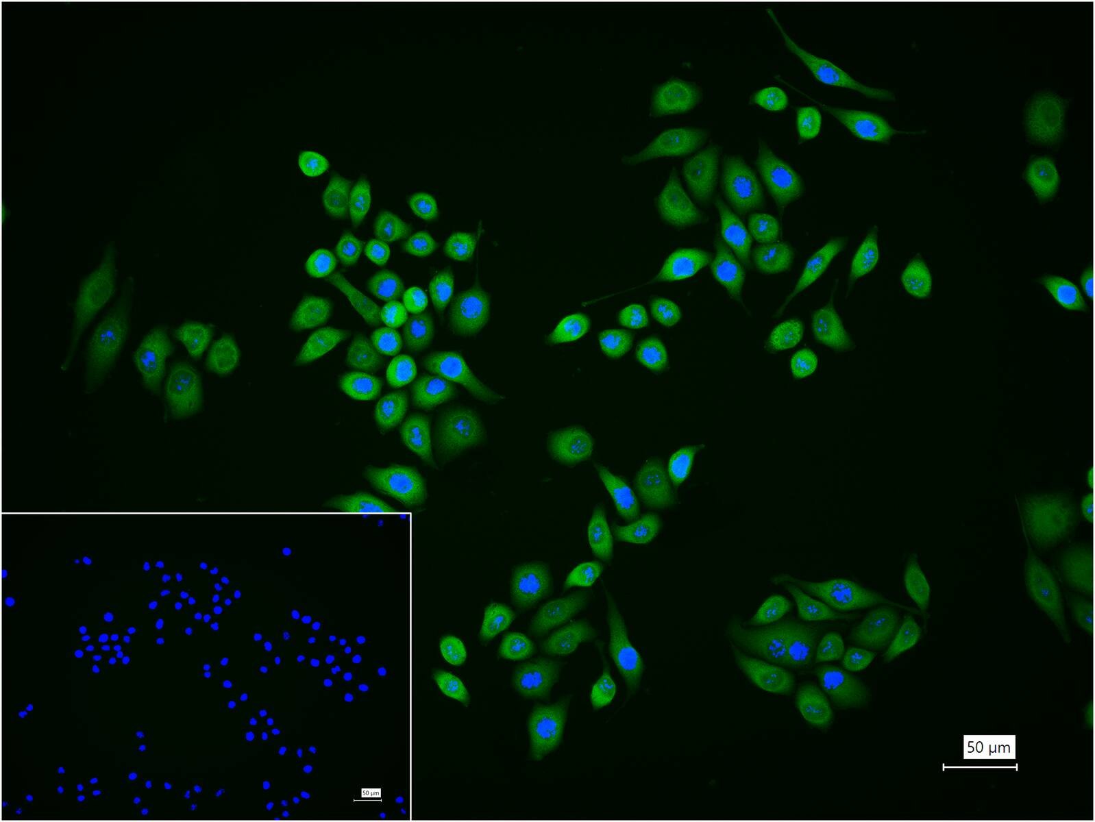 热休克蛋白-70重组兔单抗