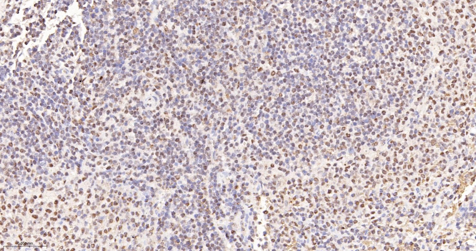 异染色质蛋白1-γ/HP-1γ单克隆抗体-bsm-33376M