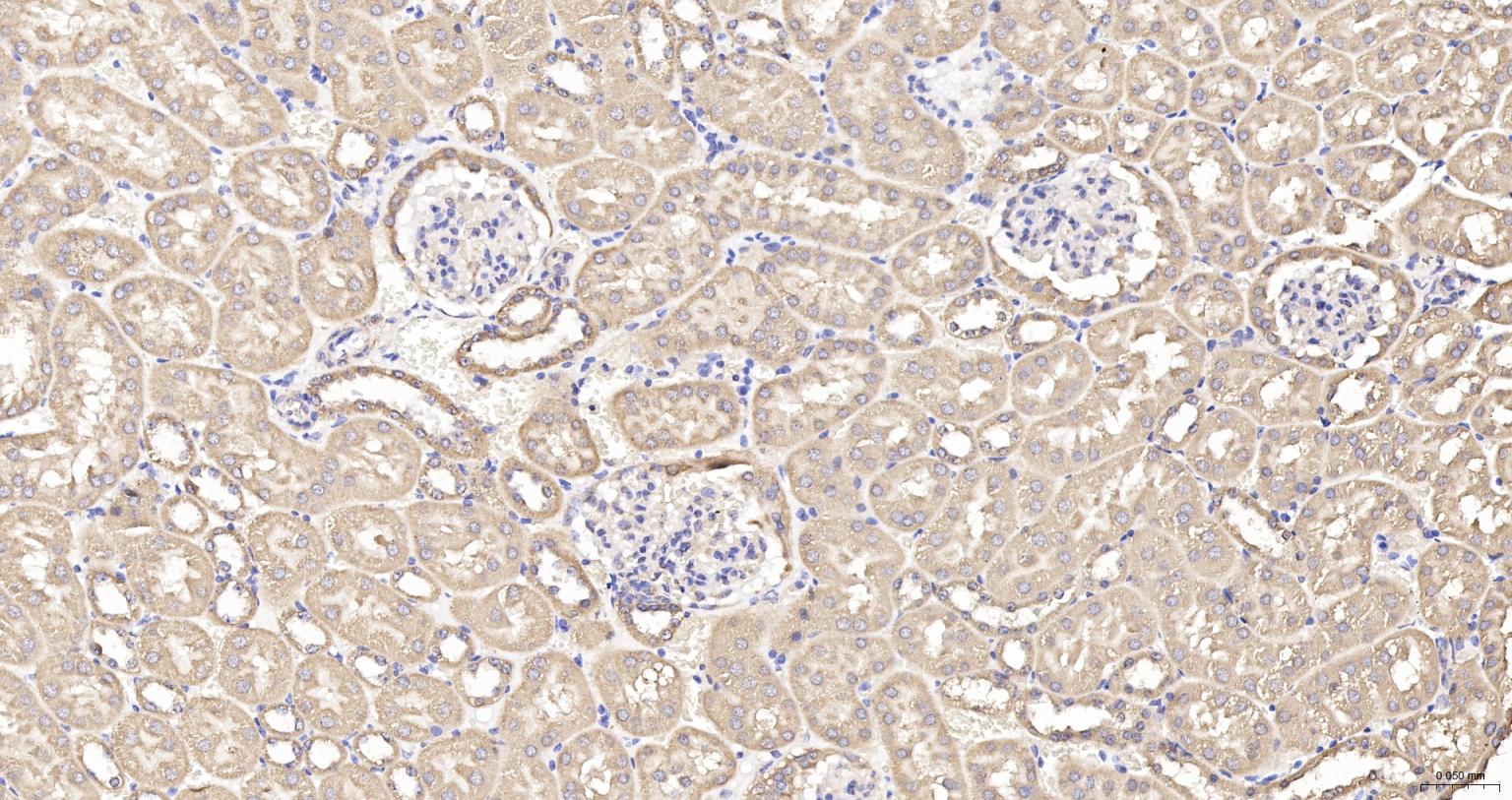 线粒体外膜受体Tom20抗体-bs-7357R