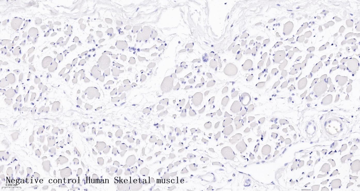 髓鞘相关糖蛋白（CD57）单克隆抗体-bsm-60790M