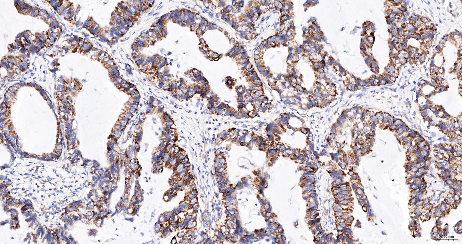 线粒体外膜受体Tom20抗体-bs-7357R