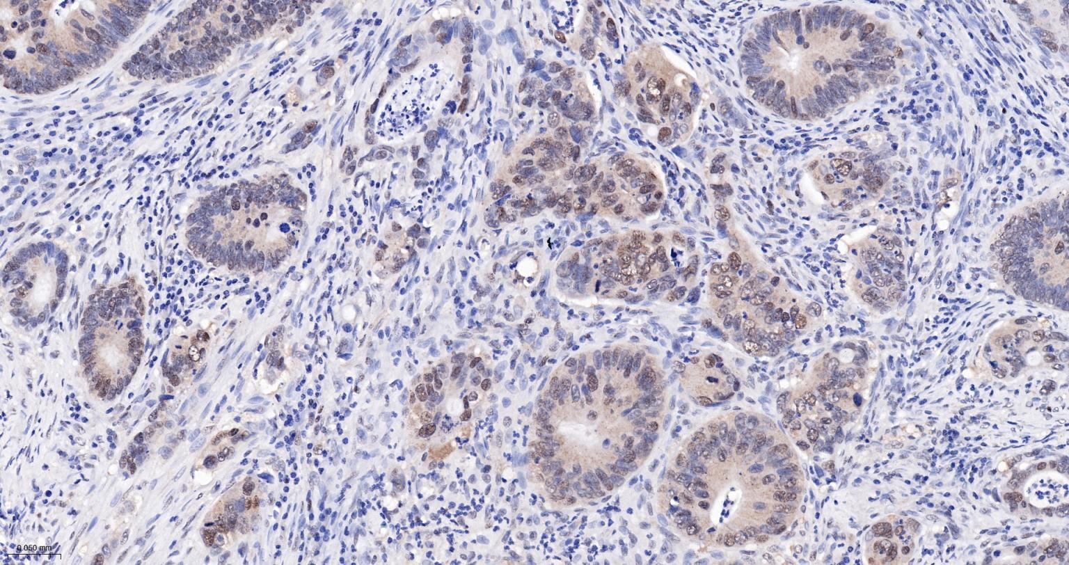热休克蛋白-60/groEL重组兔单抗