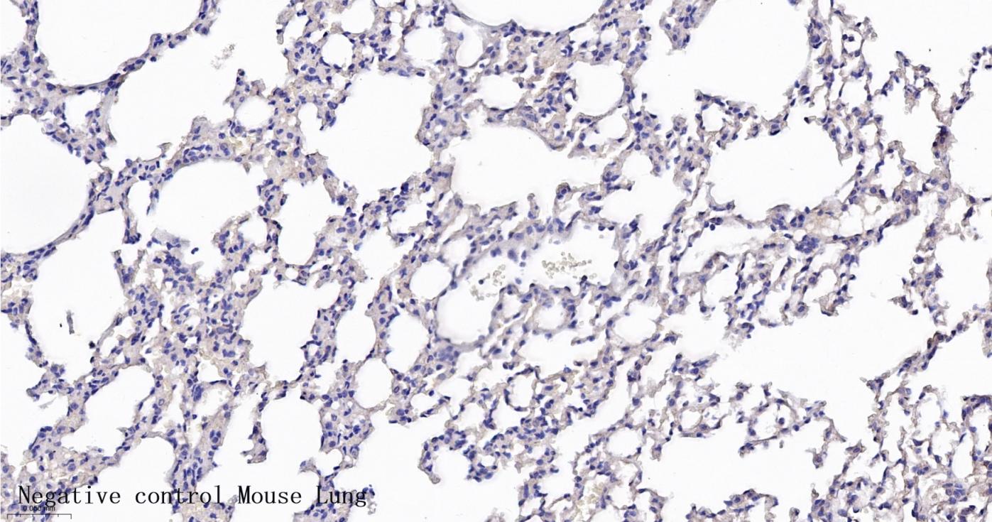 酪氨酸羟化酶兔单克隆抗体