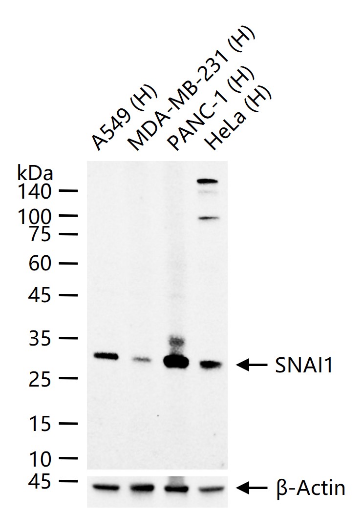 SNAI1 Mouse mAb (一抗) - WB | Bioss