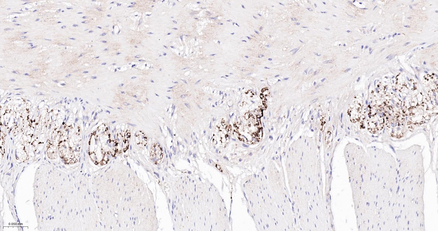 酪氨酸羟化酶兔单克隆抗体