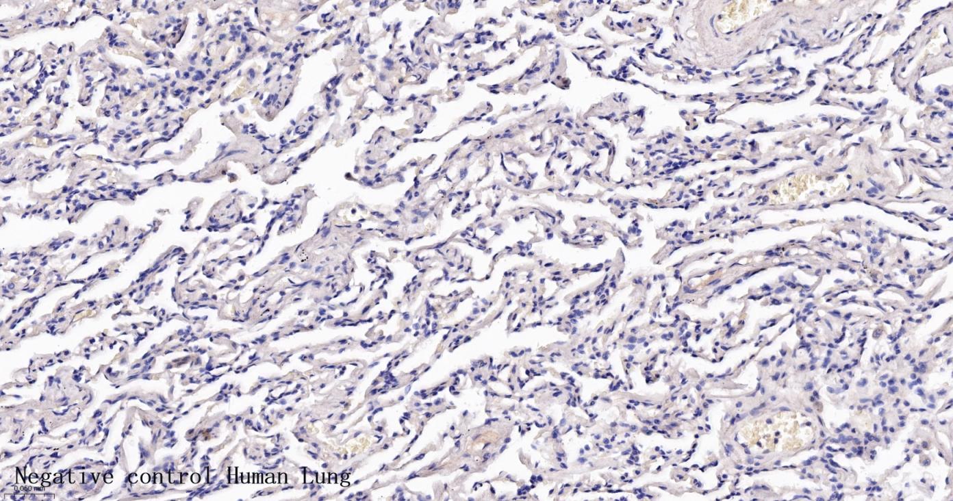 酪氨酸羟化酶兔单克隆抗体