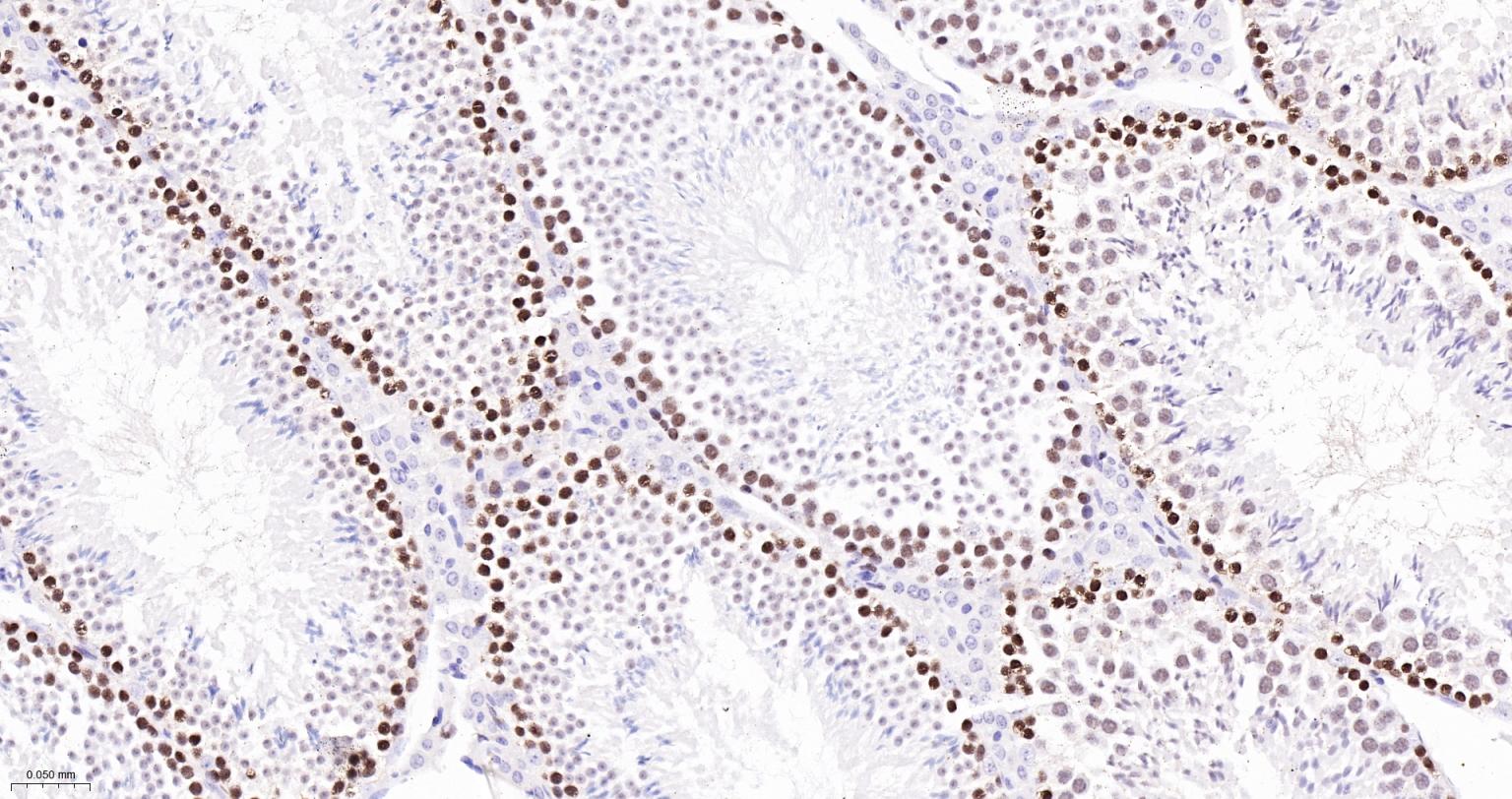 微小染色体维持缺陷蛋白2重组兔单抗