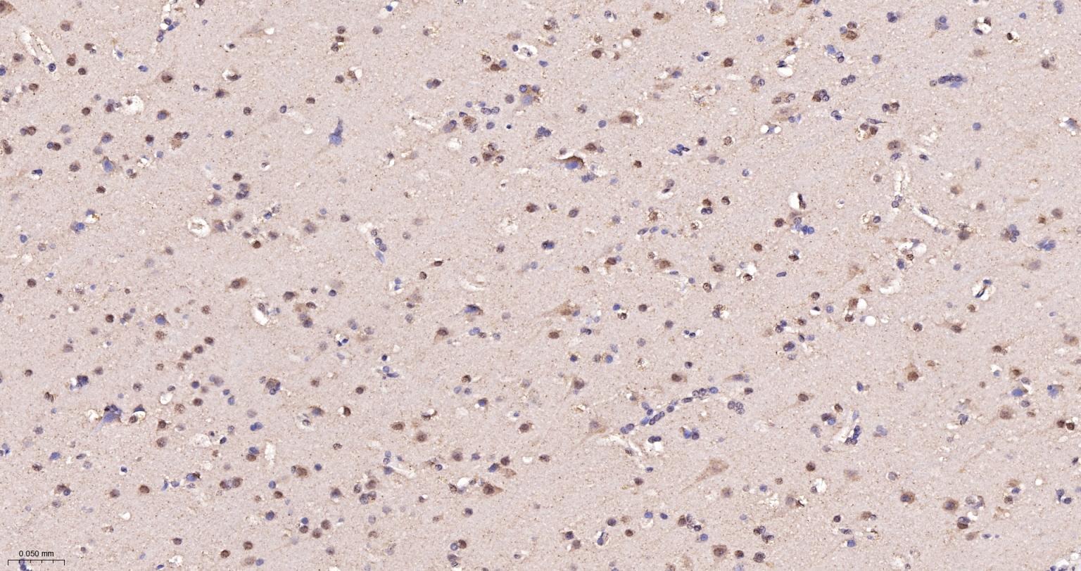 热休克蛋白-60/groEL重组兔单抗