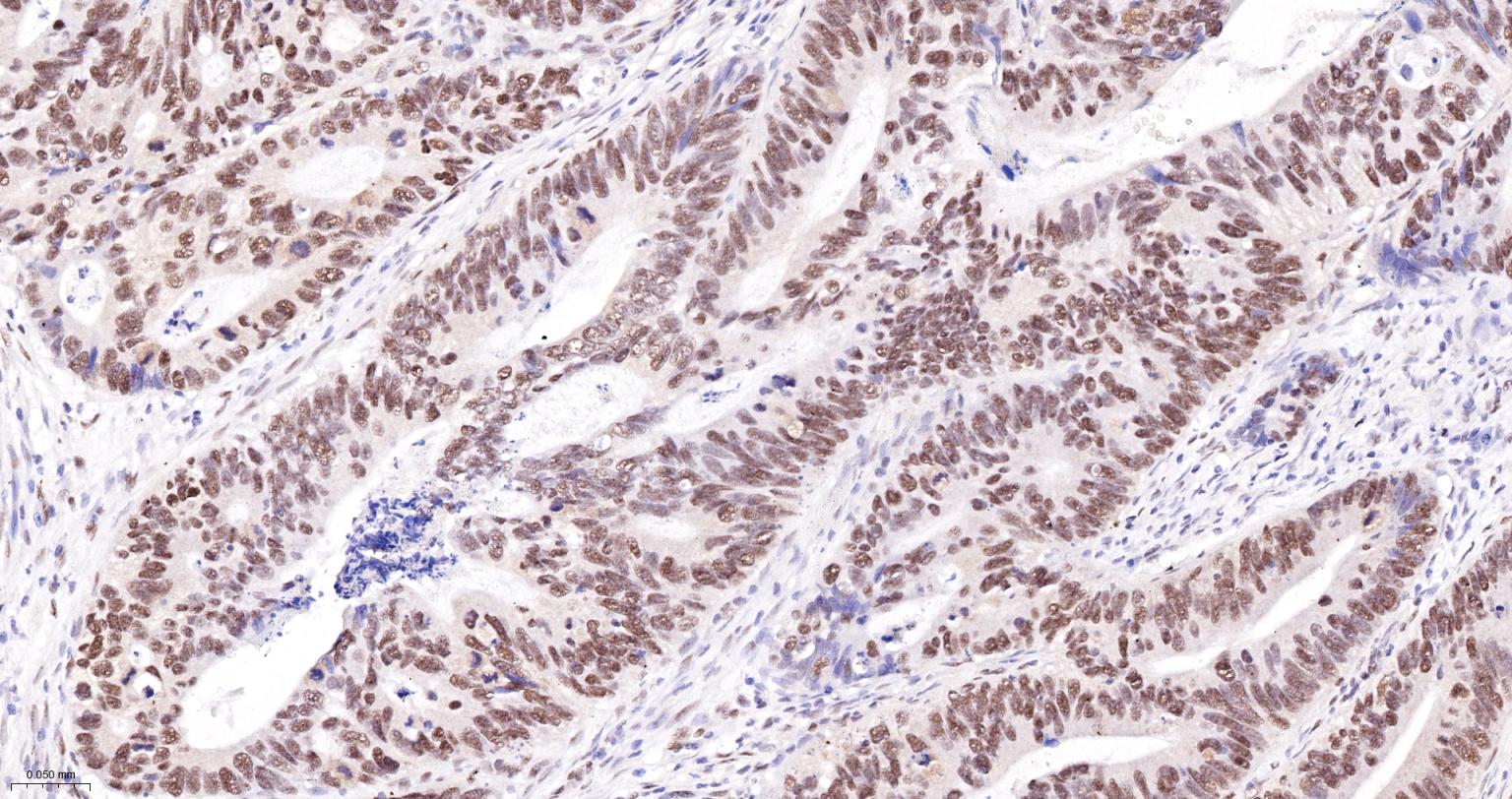 异染色质蛋白1-γ/HP-1γ单克隆抗体-bsm-33376M