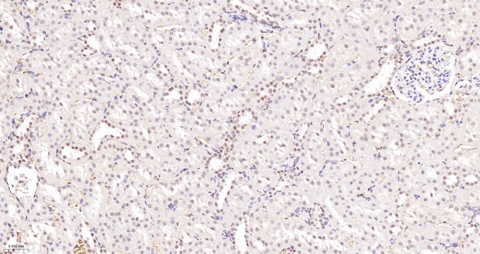 异染色质蛋白1-γ/HP-1γ单克隆抗体-bsm-33376M