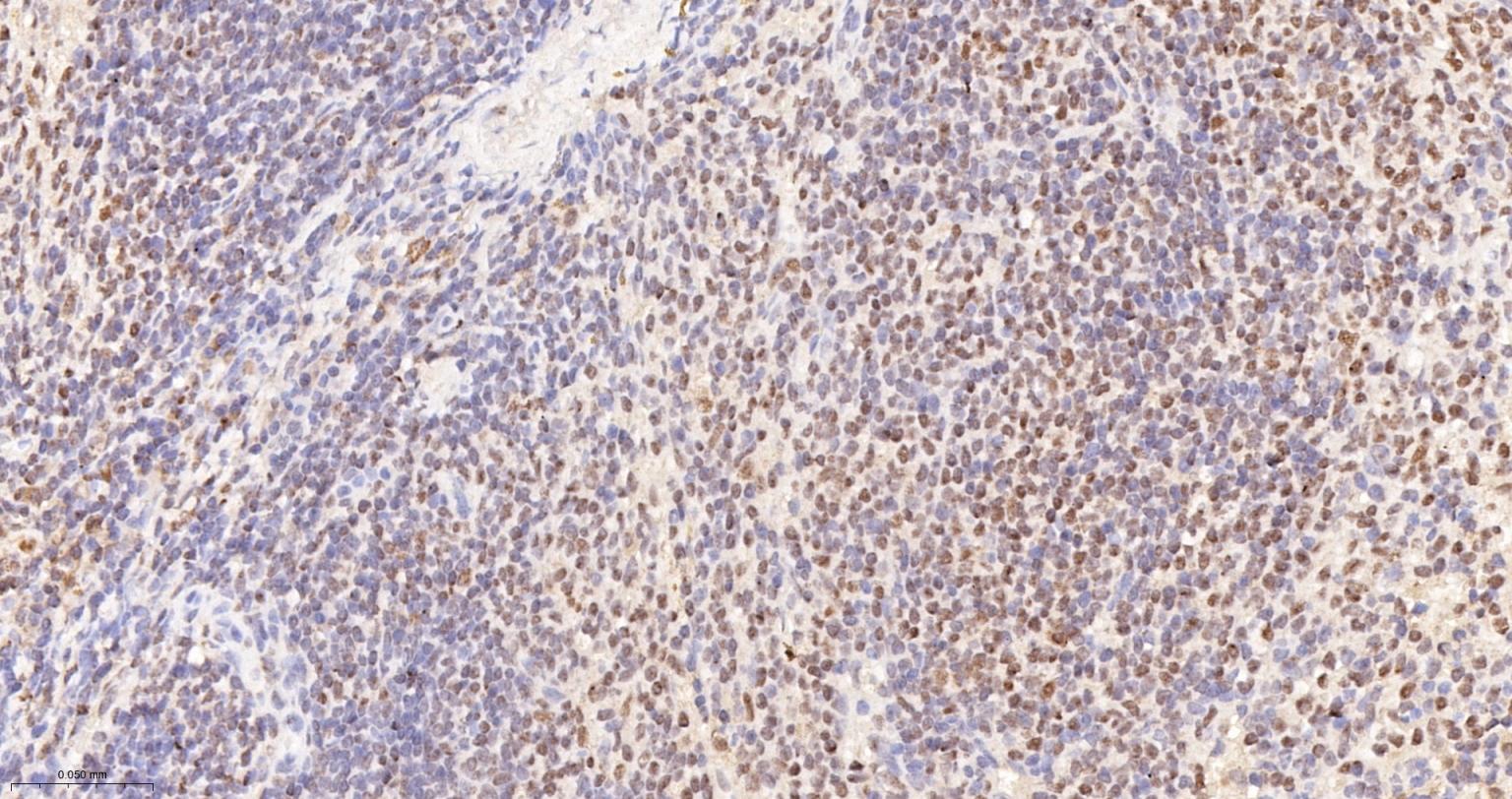 异染色质蛋白1-γ/HP-1γ单克隆抗体-bsm-33376M