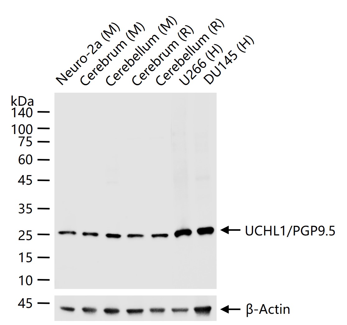 UCHL1/PGP9.5 Mouse mAb (一抗) - WB,IHC-P,IHC-F,IF | Bioss