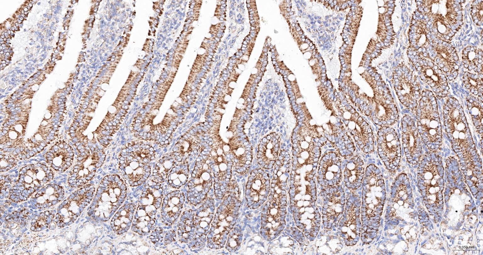 线粒体外膜受体Tom20抗体-bs-7357R