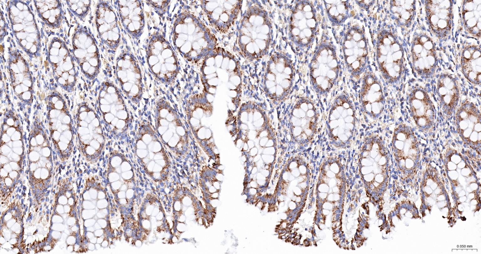 线粒体外膜受体Tom20抗体-bs-7357R