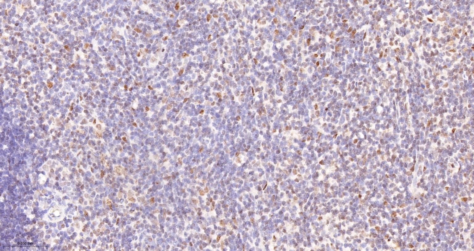 异染色质蛋白1-γ/HP-1γ单克隆抗体-bsm-33376M