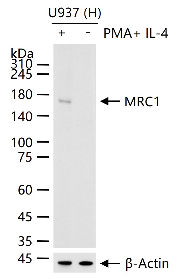巨噬细胞甘露糖受体 (CD206)重组兔单抗