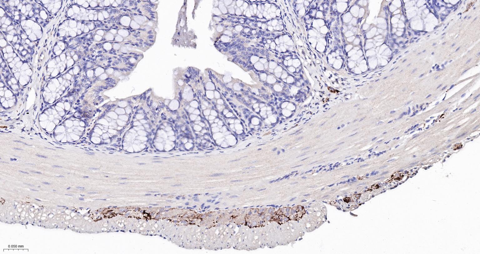 酪氨酸羟化酶兔单克隆抗体