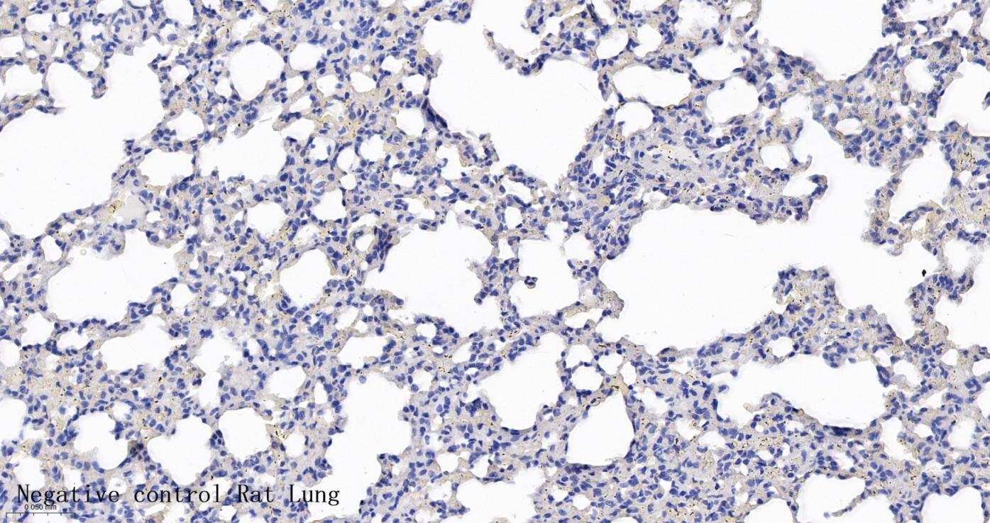 酪氨酸羟化酶兔单克隆抗体