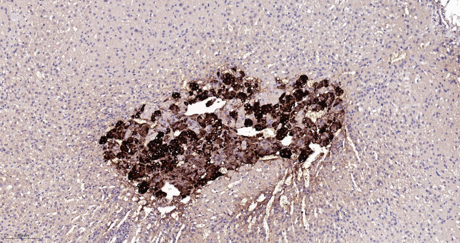 酪氨酸羟化酶兔单克隆抗体
