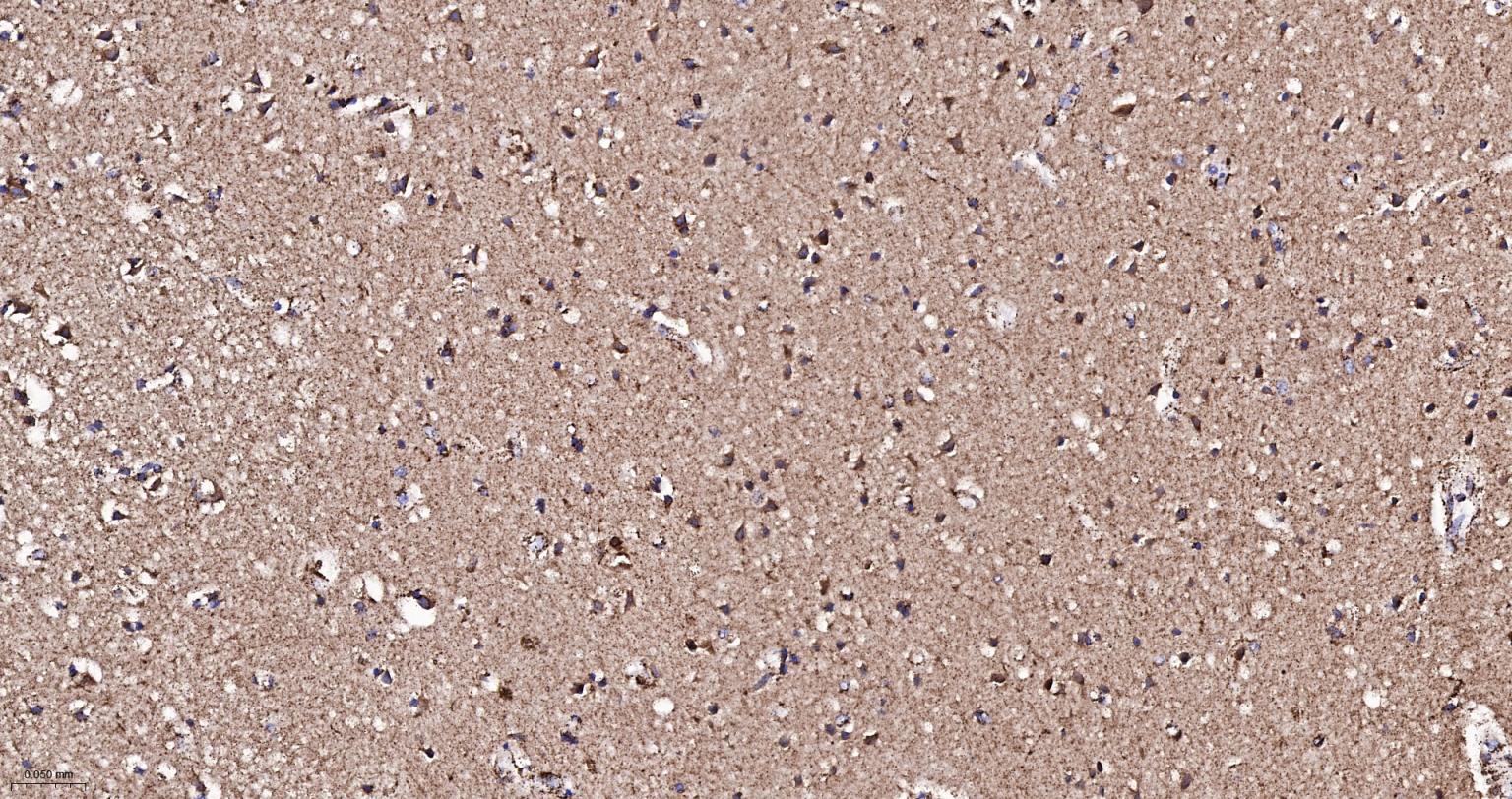 热休克蛋白-60/groEL重组兔单抗