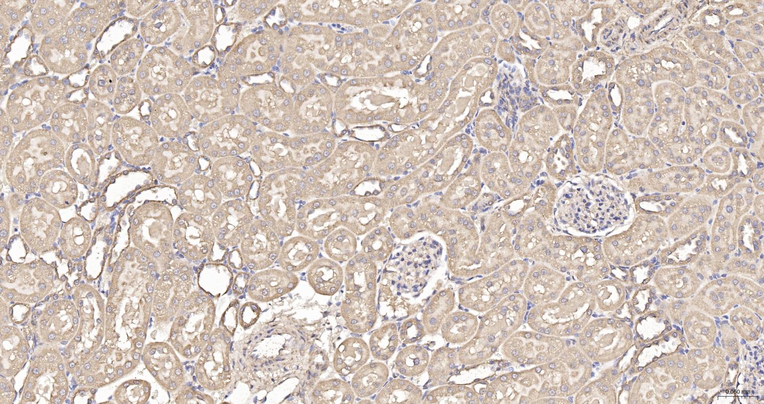 线粒体外膜受体Tom20抗体-bs-7357R