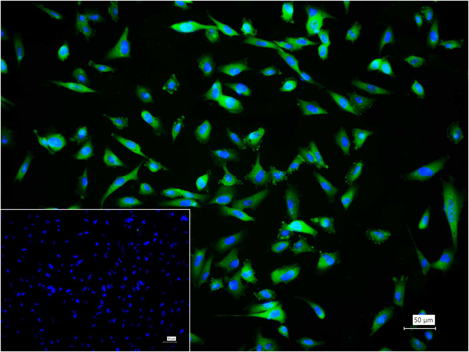 CARS1重组兔单抗-bsm-62444R