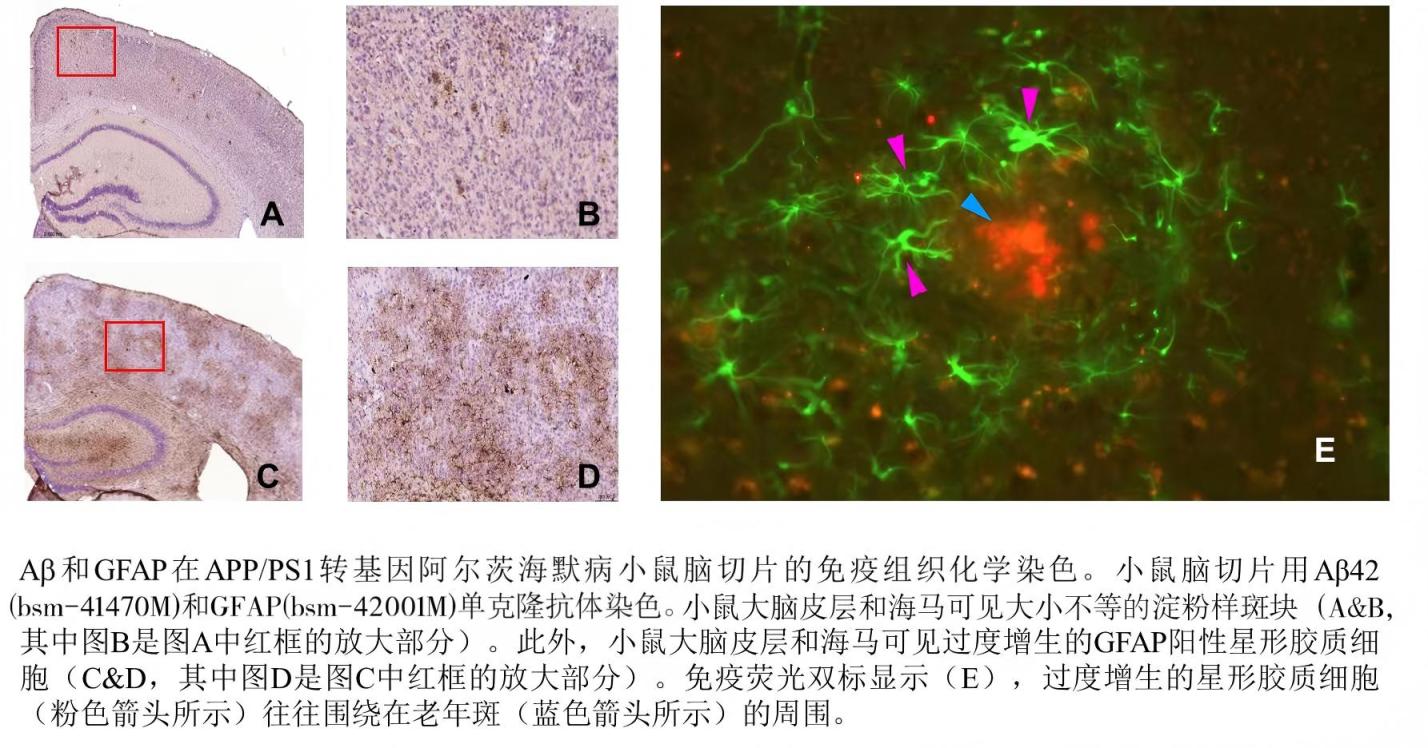 胶质纤维酸性蛋白单克隆抗体-bsm-42001M