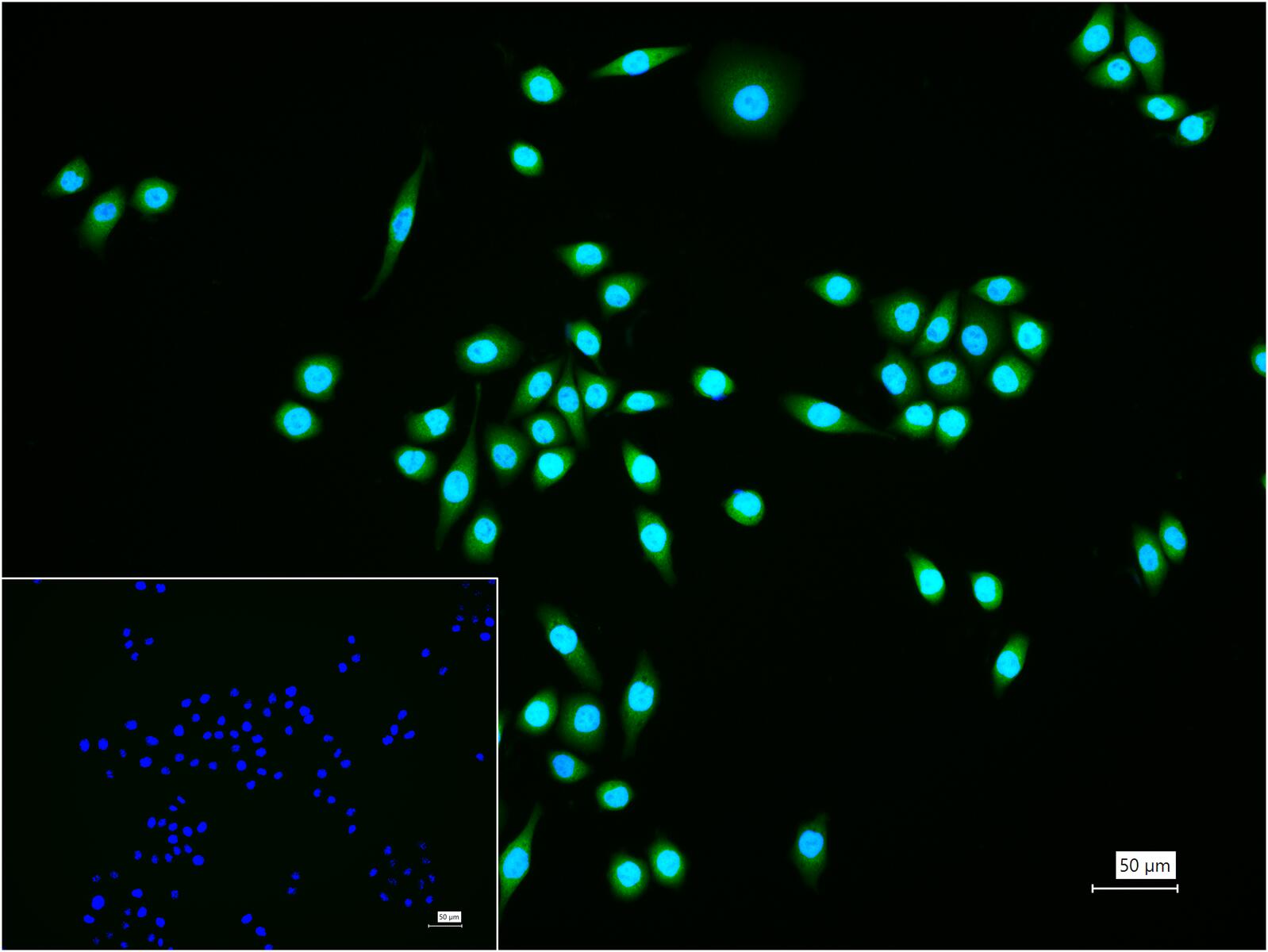 泛素蛋白（K27-linkage specific）重组兔单抗