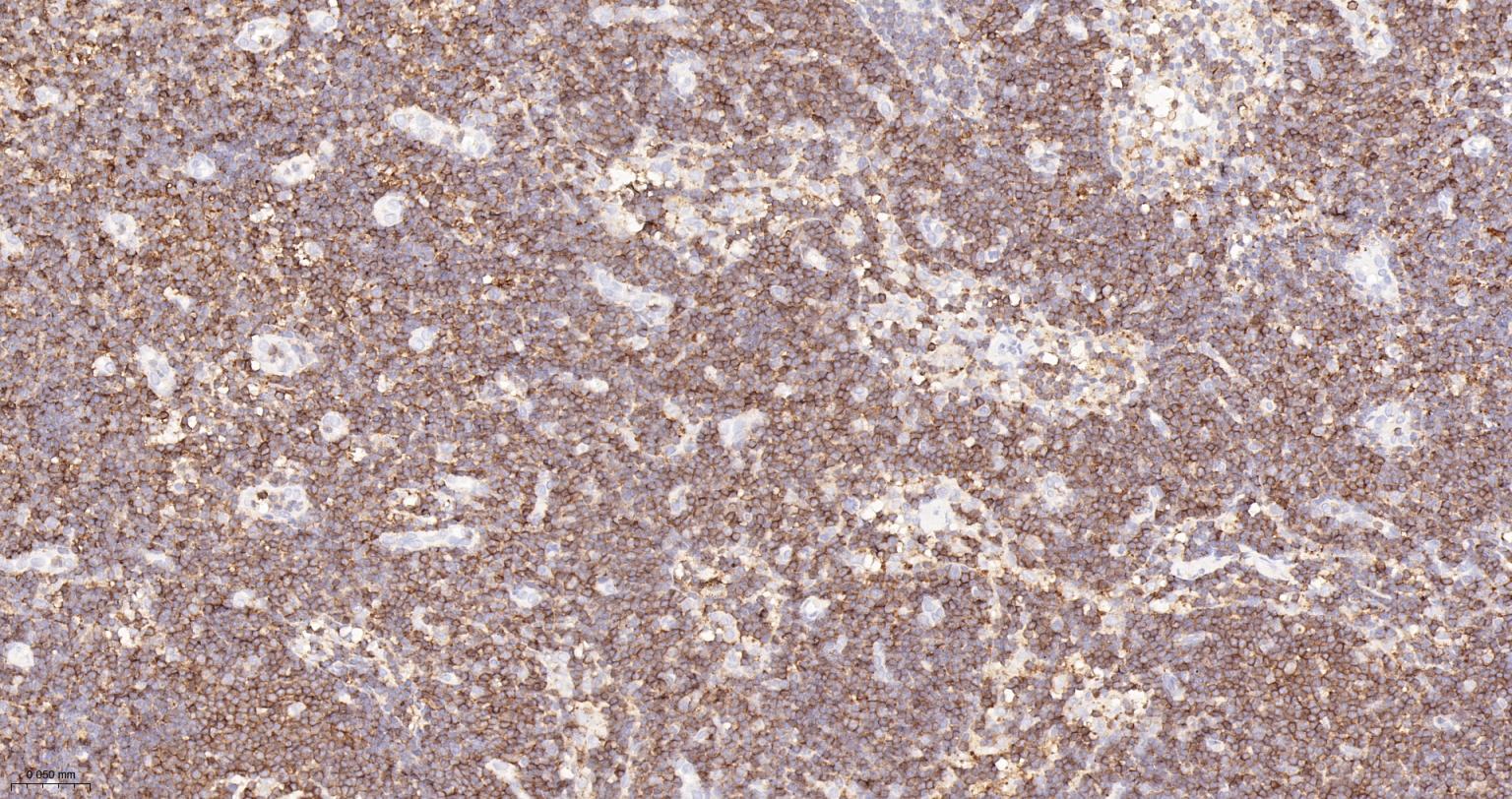 白细胞共同抗原CD45单克隆抗体-bsm-43704M