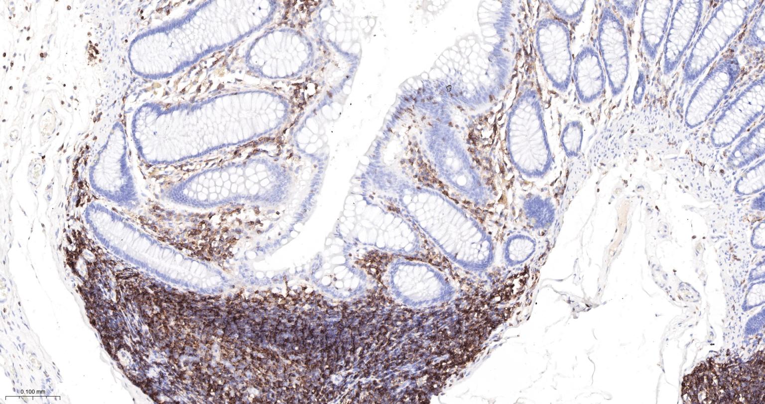 白细胞共同抗原CD45单克隆抗体-bsm-43704M
