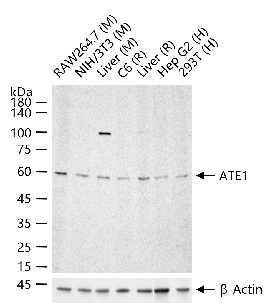 ATE1 Recombinant Rabbit mAb (一抗) - WB,IHC-P,IHC-F,IF | Bioss
