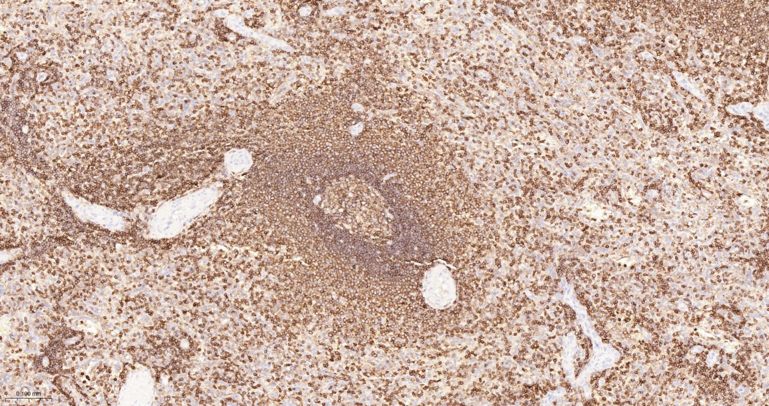 白细胞共同抗原CD45单克隆抗体-bsm-43704M