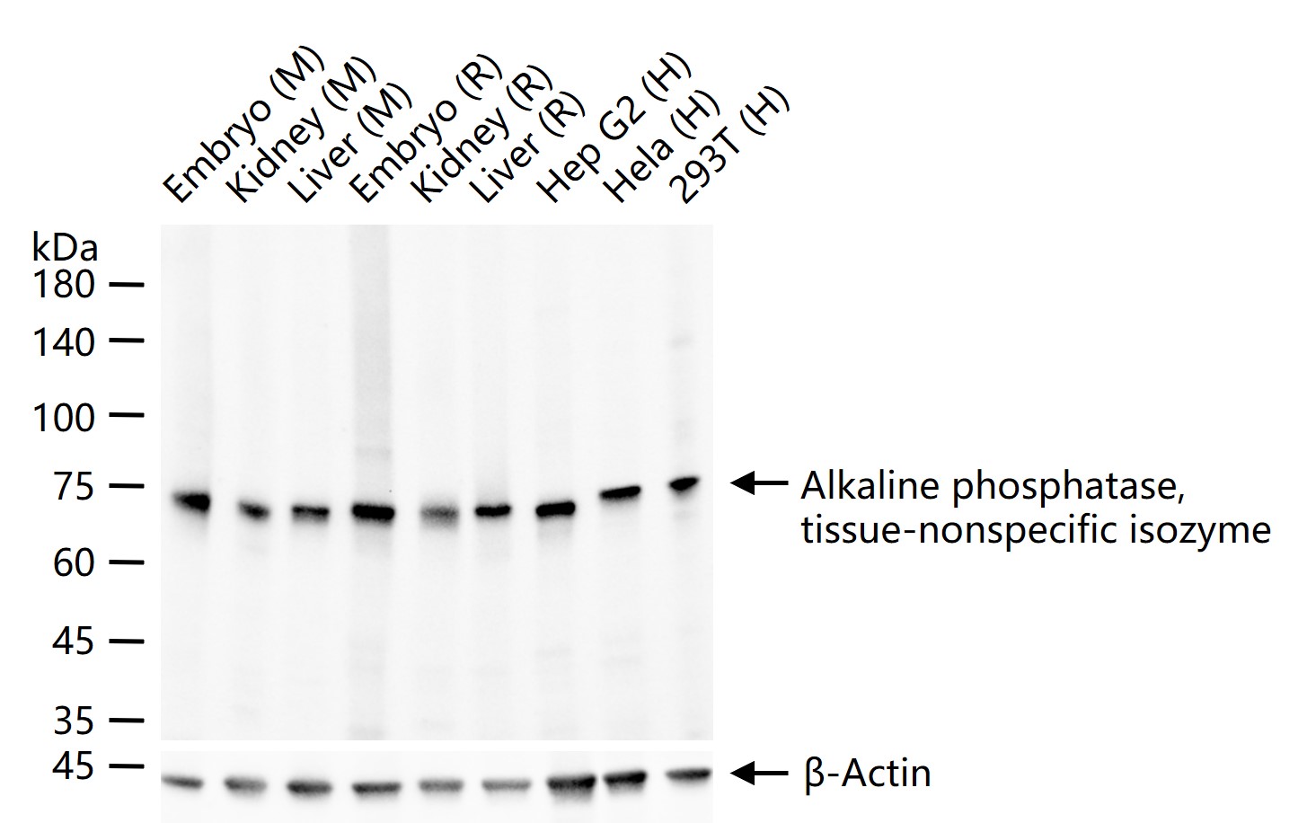 碱性磷酸酶重组兔单抗