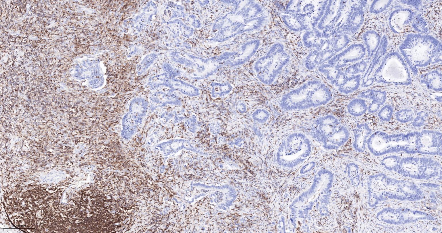 白细胞共同抗原CD45单克隆抗体-bsm-43704M