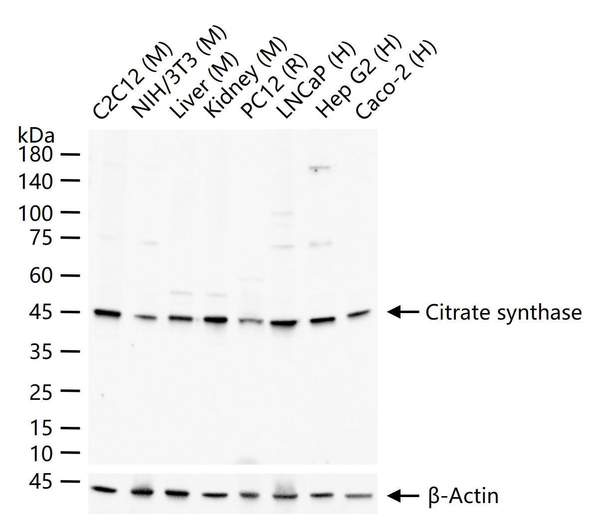 柠檬酸合成酶CISY重组兔单抗