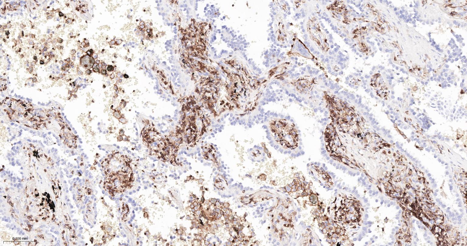 CD45 Mouse mAb (一抗) - IHC-P,IHC-F,IF | Bioss